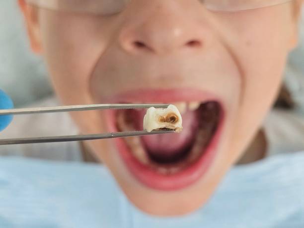 Best Emergency Denture Repair in Monette, AR